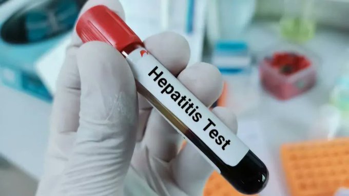 Kulgam village reports Hepatitis case, one dead, another hospitalised